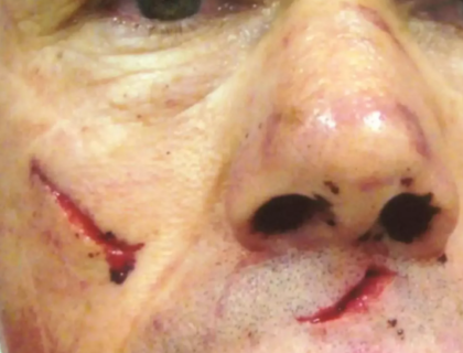 Man Almost Devoured by Great White Shark Shares Harrowing Experience of Being Trapped Inside