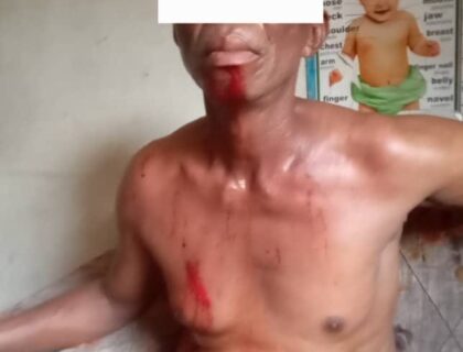 The police in Delta deny allegations of shooting at protesting women, stating that tear gas was used to disperse the protesters after they assaulted an officer.