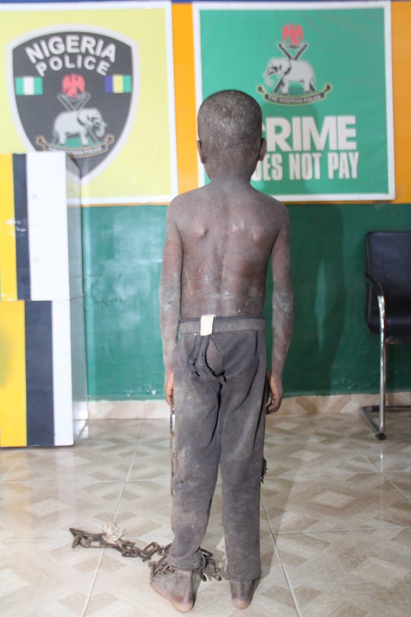 Bauchi Police Rescue 5-Year-Old Boy Chained, Locked Up And Starved For Three Days By Father