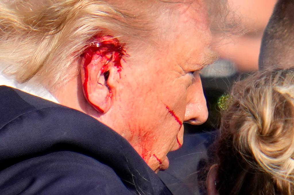 "I Should Be Dead. Many People Are Saying It’s By God I’m Still Here" - Trump Says In First Interview Since Assassination Attempt