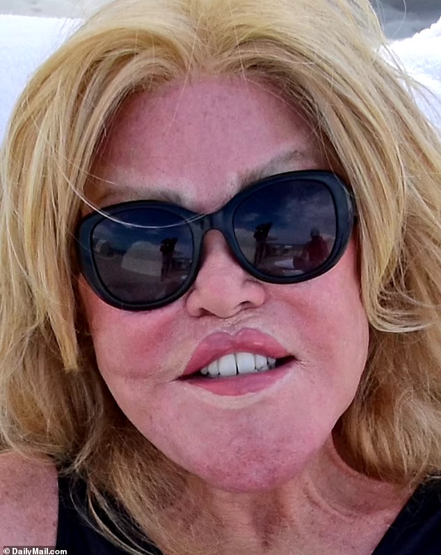 Socialite Jocelyn Wildenstein Unveils Her Natural Face in Pre-Surgery Photo