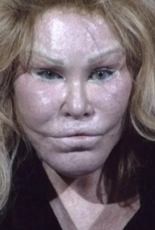 Socialite Jocelyn Wildenstein Unveils Her Natural Face in Pre-Surgery Photo