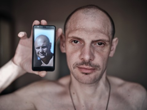 Before and After Photos Show Drastic Weight Loss in Ukrainian War Prisoners After Two Years in Russian Captivity