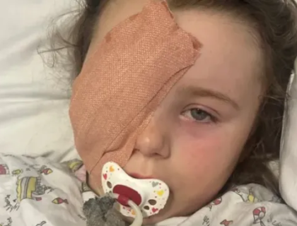 7-Year-Old Girl Loses Eye After Vape Battery Acid Explodes During Bonfire Incident