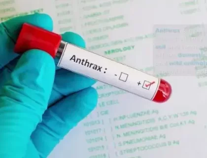 FG Alerts Nigerians About Anthrax Outbreak in Zamfara