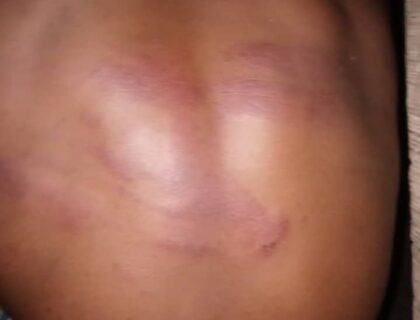 Ondo NSCDC Probes Officer for Flogging 13-Year-Old Student