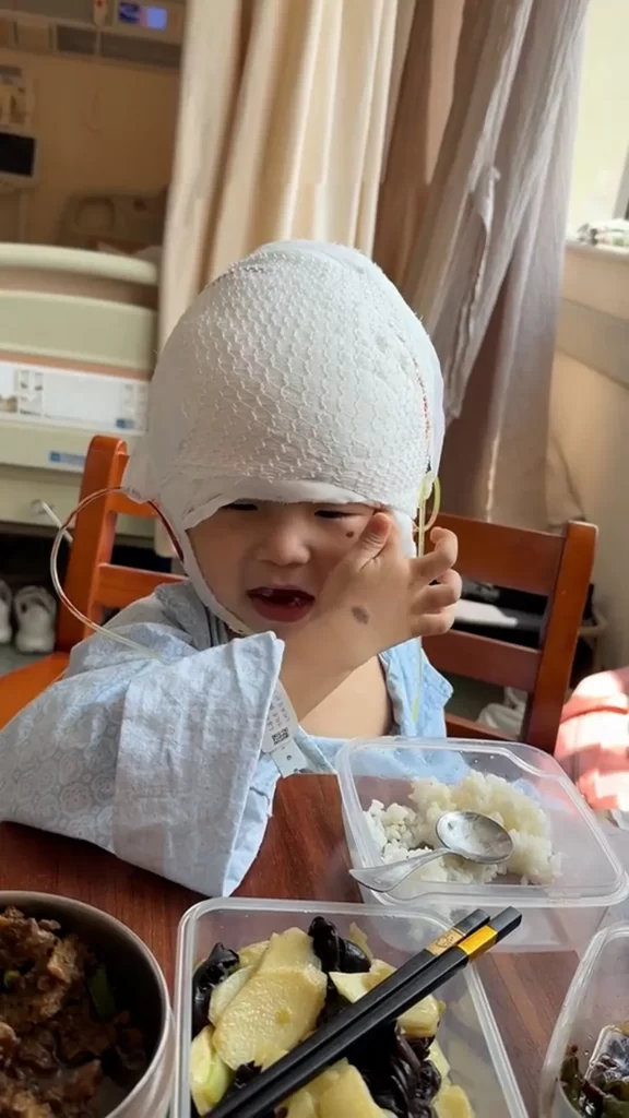 Boy Undergoes Remarkable Transformation After Rare Condition Earned Him 'Mickey Mouse' Nickname
