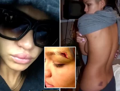 Celebrity Makeup Artist Mylah Morales Testifies About 2010 Incident, Recalls Swollen Eye, Busted Lip