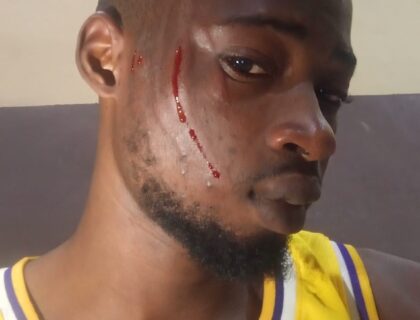 Grieving Son Assaulted by Masquerader on Way Home from Father’s Funeral in Kogi