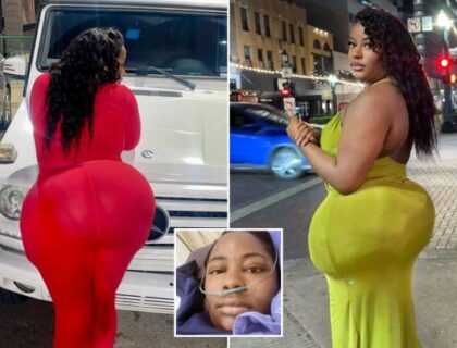 ‘My BBL Nearly Killed Me’: Woman Warns After Extreme Butt Lift in Mexico