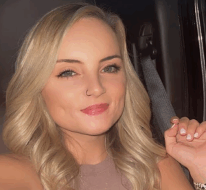 Woman Whose Lip Was Severed by Ex-Boyfriend Shares Recovery Seven Years Later