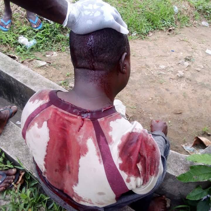 Police Arrest Three for Brutal Attack on Rivers CDC Chairman