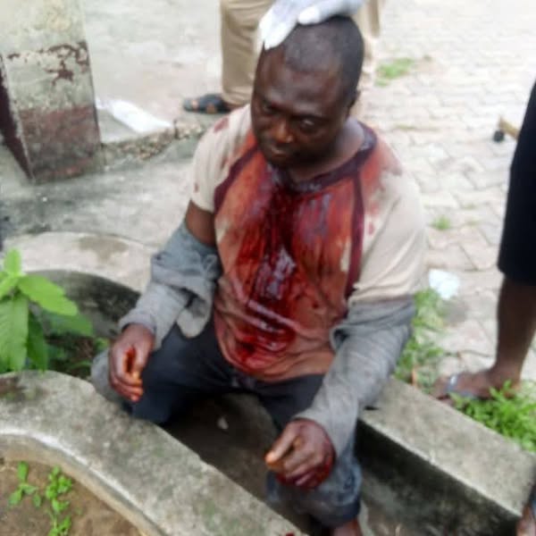 Police Arrest Three for Brutal Attack on Rivers CDC Chairman