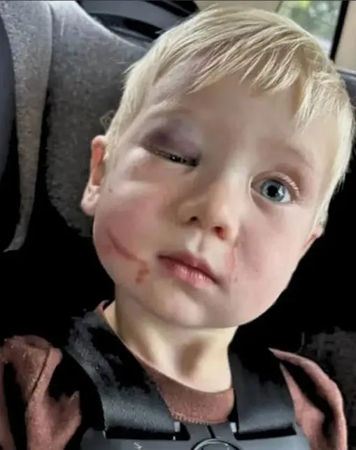 Georgia Daycare Worker Arrested For Allegedly Assaulting 1-Year-Old Boy In Her Care