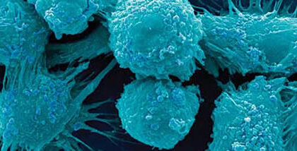 Scientists Uncover How Sugar Powers Immune Cells To Fight Cancer