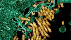 Ebola Surge Claims 65 Lives in Eastern DR Congo