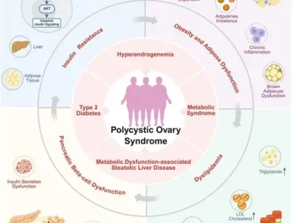 Polycystic Ovary Syndrome Rebranded to Polyendocrine Metabolic Ovarian Syndrome